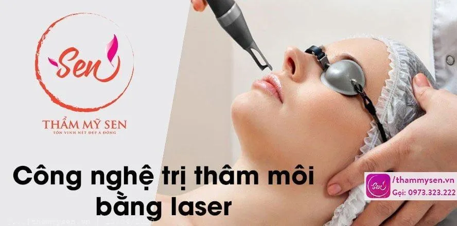 cong-nghe-tri-tham-moi-bang-laser